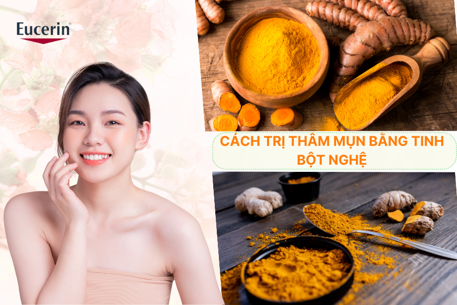 Cách trị thâm mụn bằng tinh bột nghệ